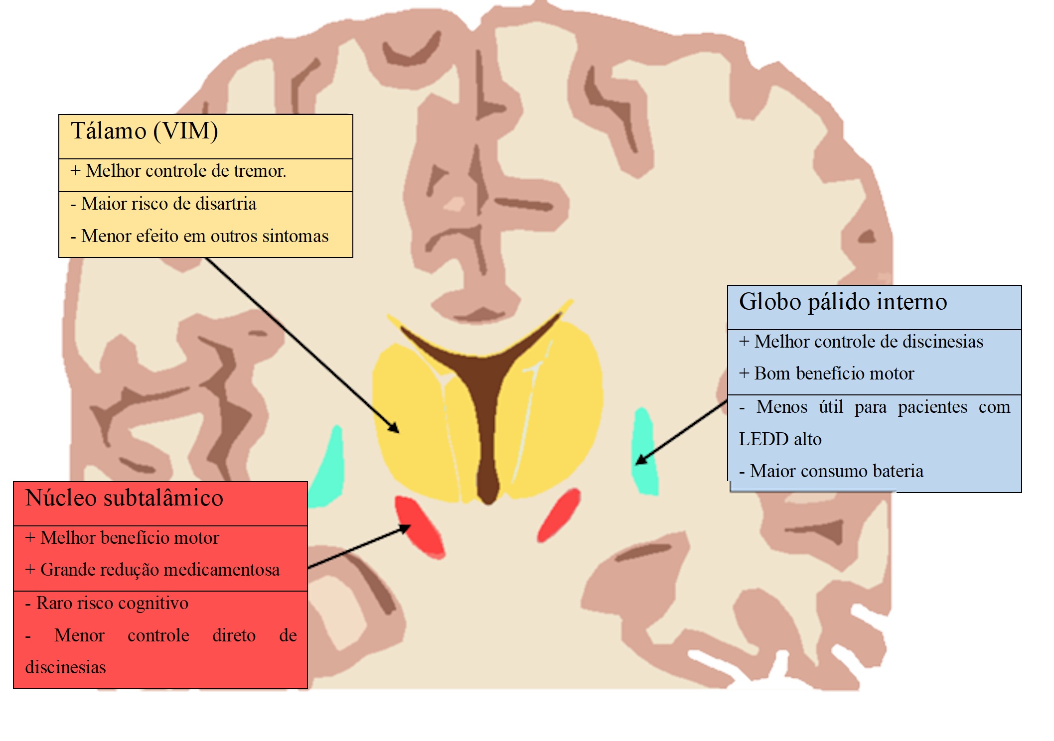Anatomia dos Alvos do DBS