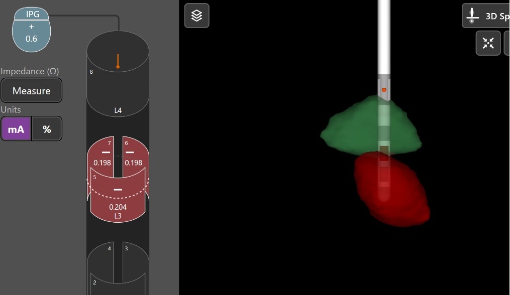 Planejamento de Alvo no Cérebro